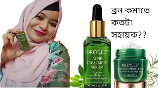 আসলেই কি ব্যবহারে ব্রন যাবে breylee acne treatment sirum and cream breleey cream review [upl. by Nosreffej250]