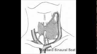 Thyroid Binaural Beats [upl. by Eimilb901]