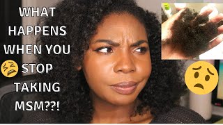 WATCH THIS BEFORE YOU STOP USING MSM FOR HAIR GROWTH  Sharing my experience [upl. by Aihsiym]