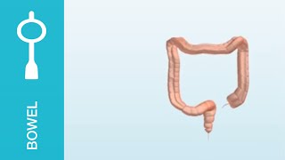 Peristeen  scintographics showing the bowel before and after Peristeen use [upl. by Artnoed]