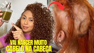 🚨CABELO CRESCE EM 10 DIAS  CRESCIMENTO ACELERADO COM APENAS 2 INGREDIENTES hair transformation 🔥 [upl. by Sybil]