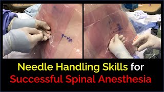 Successful Spinal Anesthesia  Skillful Needle Handling [upl. by Catarina]