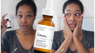 THE ORDINARY VITAMIN C  ASCORBYL GLUCOSIDE  BRIGHTENING SERUM  APPLYING TO SKIN  REVIEW [upl. by Yenmor]