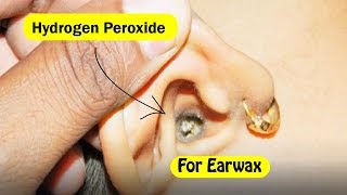 How to Use Hydrogen Peroxide To Remove Earwax [upl. by Ahsaercal760]