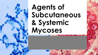 Basic Mycology 03 SUBCUTANEOUS amp SYSTEMIC MYCOSES Mahon 7th ed [upl. by Mollie111]