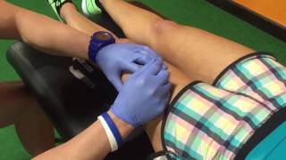 Functional Dry Needling [upl. by Annis914]