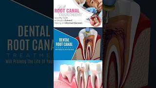 PAIN Less Endodontic Root Canal treatment RTC Niraamaya Dental Lounge Alamcode Attingal Trivandrum [upl. by Millur]