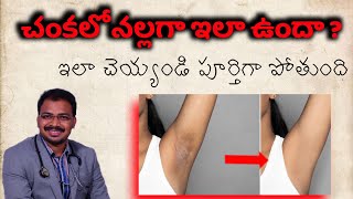 how to cure armpits infection  erythrasma how to get rid of underarms infection and mole  doctor [upl. by Neron]