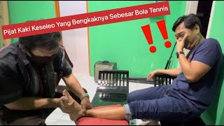 Gak Bisa Jalan Engkel Kaki Keseleo Bengkak Sebesar Bola Tennis Di Pijat Jadi Kempes Lagi [upl. by Sink]