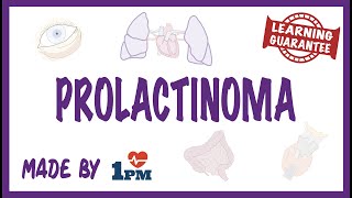 Prolactinoma  Pathology Symptoms Diagnosis Treatment [upl. by Girhiny808]