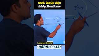 Causes of Foreskin Infection in Telugu  Treatment Range Hospital  shorts ytshorts healthcare [upl. by Burck]