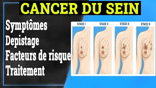 What Is Cancer What Causes Cancer amp How Is It Treated [upl. by Suzanna304]