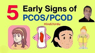 PCOS Symptoms amp Treatment Options pcos PolcysticOvarianSyndrome drabbasofficial [upl. by Lombardi]