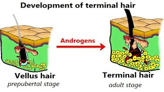 What is Vellus Hair amp Terminal Hair by Jas Sir from Sam and Jas Hair amp Makeup Academy MUMBAI [upl. by Leid]