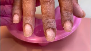 How to remove acrylic nails  Nail soak off [upl. by Einnaf]