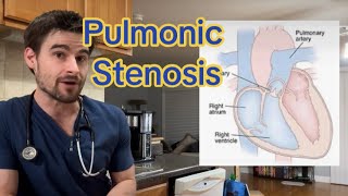 Pulmonic Stenosis in Pets [upl. by Orlantha358]