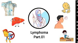 Lymphoma  Hodgkins lymphoma  Sign and symptoms  Diagnosis  Treatment [upl. by Frodi767]