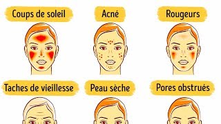 6 Masques du Visage Pour Améliorer ta Peau [upl. by Adalbert]