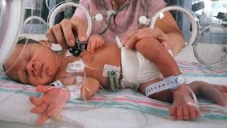 NICU Baby Sucking lips 👄 nicu nicubaby NICU Care Newborn Baby 👶 [upl. by Yhtrod]