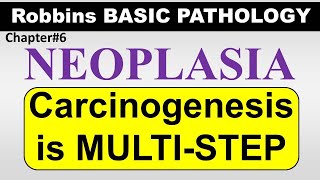 Chp6Part5 Robbins Basic Patho  CARCINOGENESIS A Multi step Process General Pathology Neoplasia [upl. by Brader]