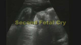 Discovery Channel Video Baby Cries in Wombswf [upl. by Nosoj]