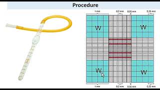 Total WBC counting by using hemocytometer  Neubaurs Chamber  urduhindi [upl. by Yrrab]