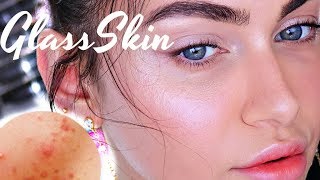 How To Glass Skin For Acne Pimple Prone Skin  Ruby Golani [upl. by Ainer155]