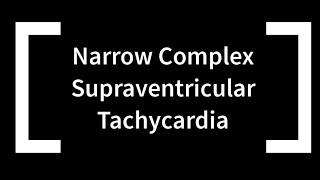 Narrow Complex Supraventricular Tachycardia [upl. by Aikenahs72]