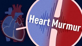 How to Identify Heart Murmurs  Ausmed Lectures [upl. by Oraneg]