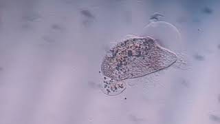 Paramecium Dying [upl. by Tillford]