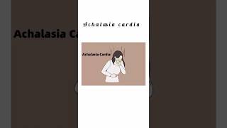 Achalasia caradia kattrucate medicalreels achalasia peristaltic triads oesophagus nerves [upl. by Brunn869]