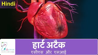 हार्ट अटैक एसीएस और एमआई  Heart Attack ACS amp MI  Hindi [upl. by Fabria]