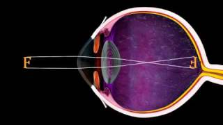 The Eye and Focus  3D Medical Animation  ABP © [upl. by Yvad463]