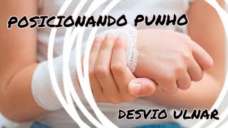 POSICIONAMENTO RX DE PUNHO  DESVIO ULNAR [upl. by Assiralk]