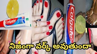 I Tried Popular DIY Feet Whitening Methods [upl. by Minnie]