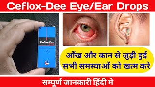 CefloxDee eye dropCefloxDee Ear dropCiprofloxacin amp Dexamethasone EyeDear drops [upl. by Kreis253]