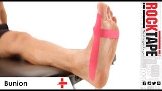 RockTape  Kinesiology Tape Instruction  Bunion [upl. by Allana]