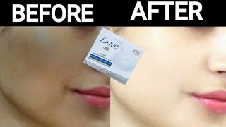 Dove soap for skin whitening cream  Dove white beauty Bar whitens skin  Skin whitening remedies [upl. by Petronilla624]