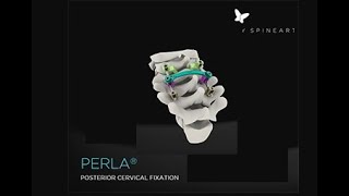 Spineart PERLA Posterior Cervical System [upl. by Ahsiyt]