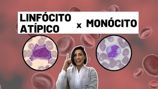 Como diferenciar linfócito atípico do monócito  Biomedicina  Hematologia [upl. by Anelahs435]