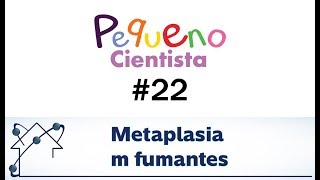 Metaplasia em fumantes [upl. by Dnesnwot3]