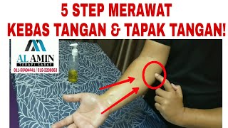 Urut Kebas Tangan amp Tapak Tangan  Carpal Tunnel Sindrom  01150404441 [upl. by Bailey]