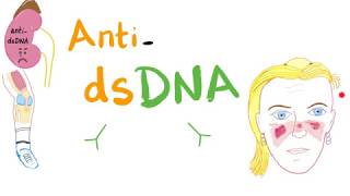 Antidouble Stranded DNA AntidsDNA Antibodies  Systemic Lupus Erythematosus SLE [upl. by Nedlog]