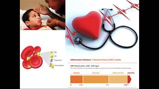 Autism Research for Families Biomarkers Bone Density and Behavior [upl. by Aneelas910]