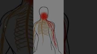 cervical spondylitis special test spurlings testtrending trendingshorts shortsfeed trend [upl. by Oitaroh167]