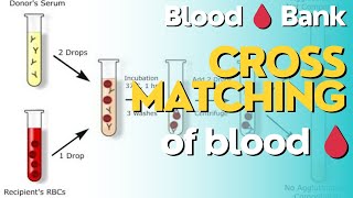 Blood Crossmatching🩸 The First Step in Blood Transfusions Education Point Blood Bank Processor [upl. by Nyrak]