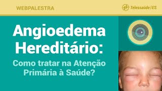 Webpalestra Angioedema Hereditário como identificar na Atenção Básica  Telessaúde ES 19052016 [upl. by Smart]