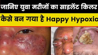 Mucormycosis symptoms and treatment after covid ब्लैक फंगस हैप्पी हइपोक्सिया ले लेगा जान [upl. by Blus420]