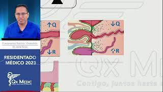 Obstetricia  5 Estados Hipertensivos [upl. by Lena]