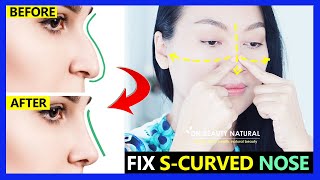 BEST NOSE MASSAGE  Get Nose Straight amp Slim  Fix Sshaped amp Crooked Nose Lift Nose Tip [upl. by Shamma]